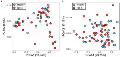 A protease activity-based machine-learning approach as a complementary tool for conventional diagnosis of diarrhea-predominant irritable bowel syndrome